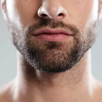 Beard Transplant