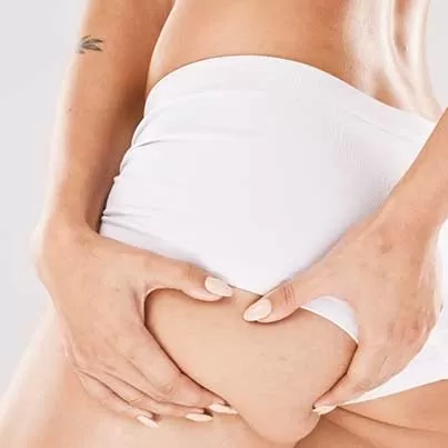 Butt Implants