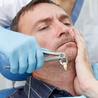 Complex Tooth Extractions
