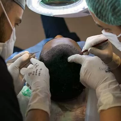DHI Hair Transplant