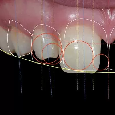 Digital Smile Design