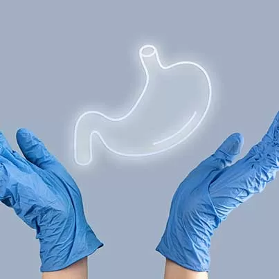 Duodenal Switch for Type 2 Diabetes