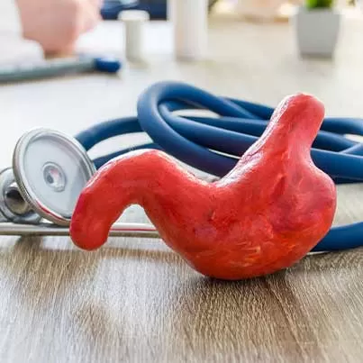 Endoscopic Sleeve Gastroplasty
