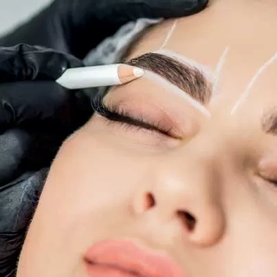 Eyebrow Transplant
