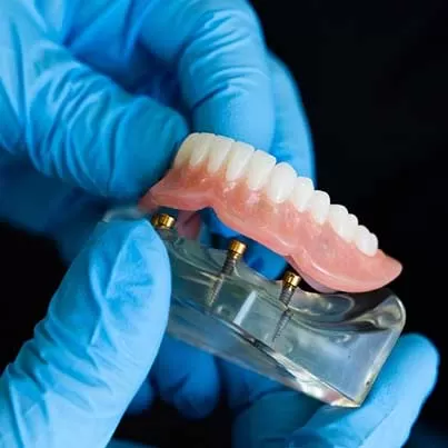 Fixed Dentures