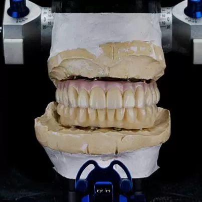 Fixed Prosthesis