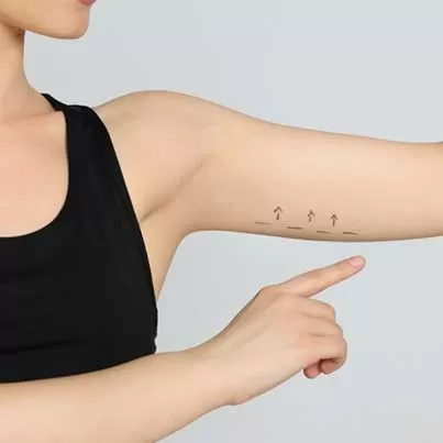 Full Arm Lift