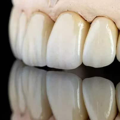Full Ceramic Zirconium Implants