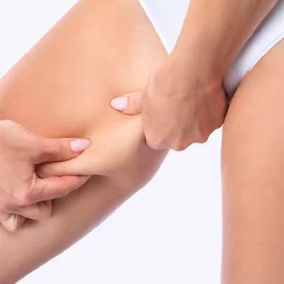 Inner Thigh Lift