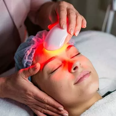 IPL (Intense Pulsed Light)