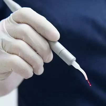 Laser Gum Surgery