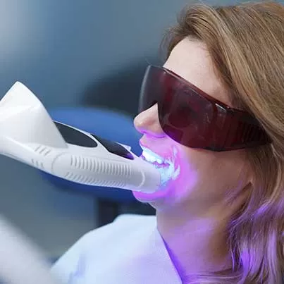 Laser Teeth Whitening