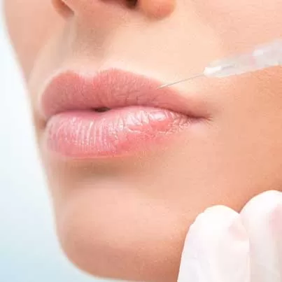 Lip Augmentation