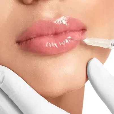 Lip Filler