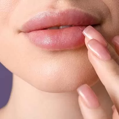 Lip lift