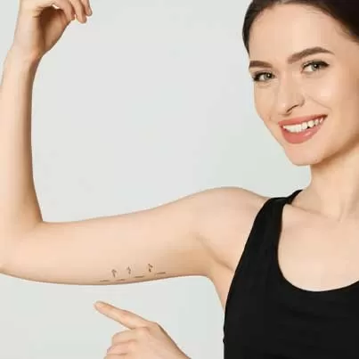 Mini Arm Lift