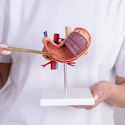 Mini Gastric Bypass