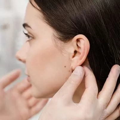 Otoplasty