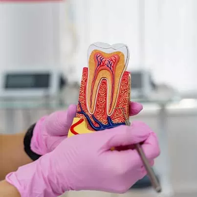 Pediatric Root Canal