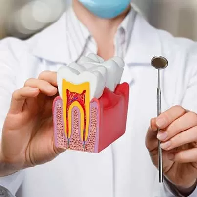Single Root Canal Treatment