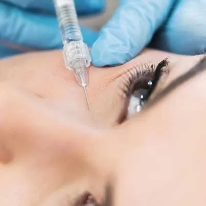 Tear Trough Filler